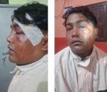 सल्यानका पत्रकार थापामाथि कुटपिट