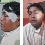 सल्यानका पत्रकार थापामाथि कुटपिट